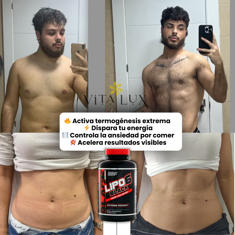 60 Caps Lipo-6 Black Ultra Concentrate™ – QUEMA GRASA EXTREMA | Energía, Metabolismo Acelerado + 🎁 Plan 15 Días Metabolismo Turbo GRATIS + Envío Gratis
