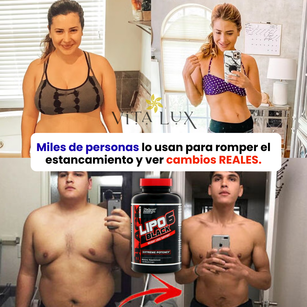 60 Caps Lipo-6 Black Ultra Concentrate™ – QUEMA GRASA EXTREMA | Energía, Metabolismo Acelerado + 🎁 Plan 15 Días Metabolismo Turbo GRATIS + Envío Gratis