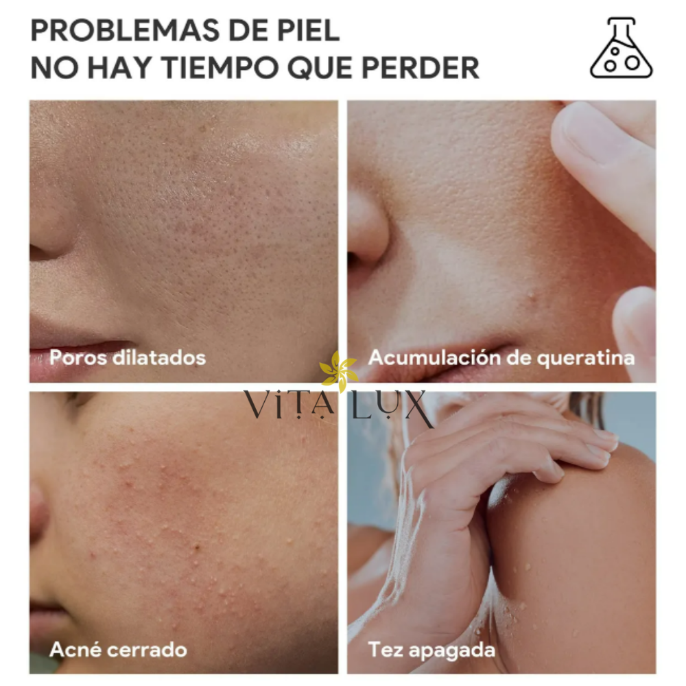 2 en 1 GlycoClear™ 7% – Solución Exfoliante Aclarante Multi-Zonas | Axilas, Entrepierna, Cuello, Rodillas, Codos y Rostro + 🎁 Guía “10 Secretos Dermatológicos para Aclarar Manchas y Lograr Piel de Porcelana” + Envío Gratis