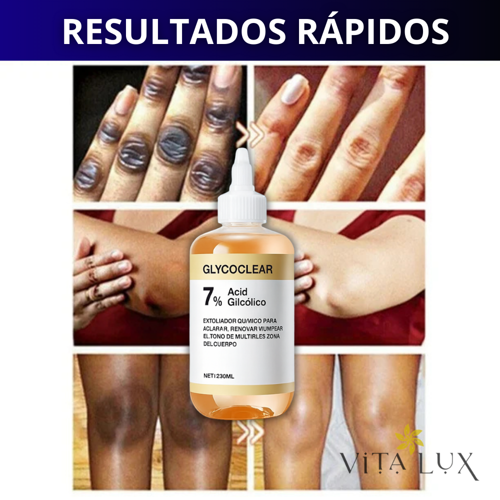 2 en 1 GlycoClear™ 7% – Solución Exfoliante Aclarante Multi-Zonas | Axilas, Entrepierna, Cuello, Rodillas, Codos y Rostro + 🎁 Guía “10 Secretos Dermatológicos para Aclarar Manchas y Lograr Piel de Porcelana” + Envío Gratis