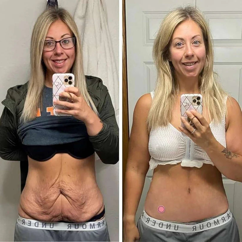 100 Parches para Bajar de Peso SlymFit®️ + 🎁Guia Infalible para perder tallas en 14 dias + Envio Gratis