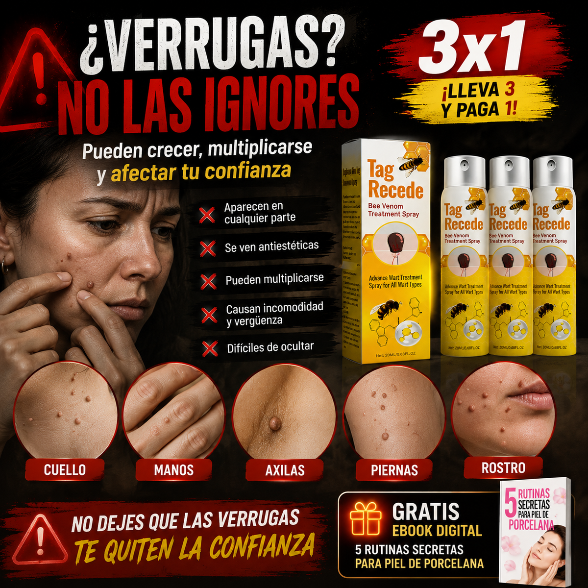 3x1 BeeClear™ Spray para Verrugas con Veneno de Abeja | Reduce la Apariencia de Verrugas + 🎁 “5 Rutinas Secretas para una Piel de Porcelana” + Envío Gratis
